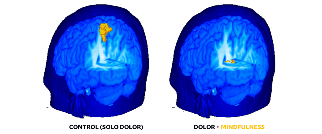 ¿Qué es y para qué sirve el mindfulness? – Esto dice la ciencia 7 Reducción de la actividad