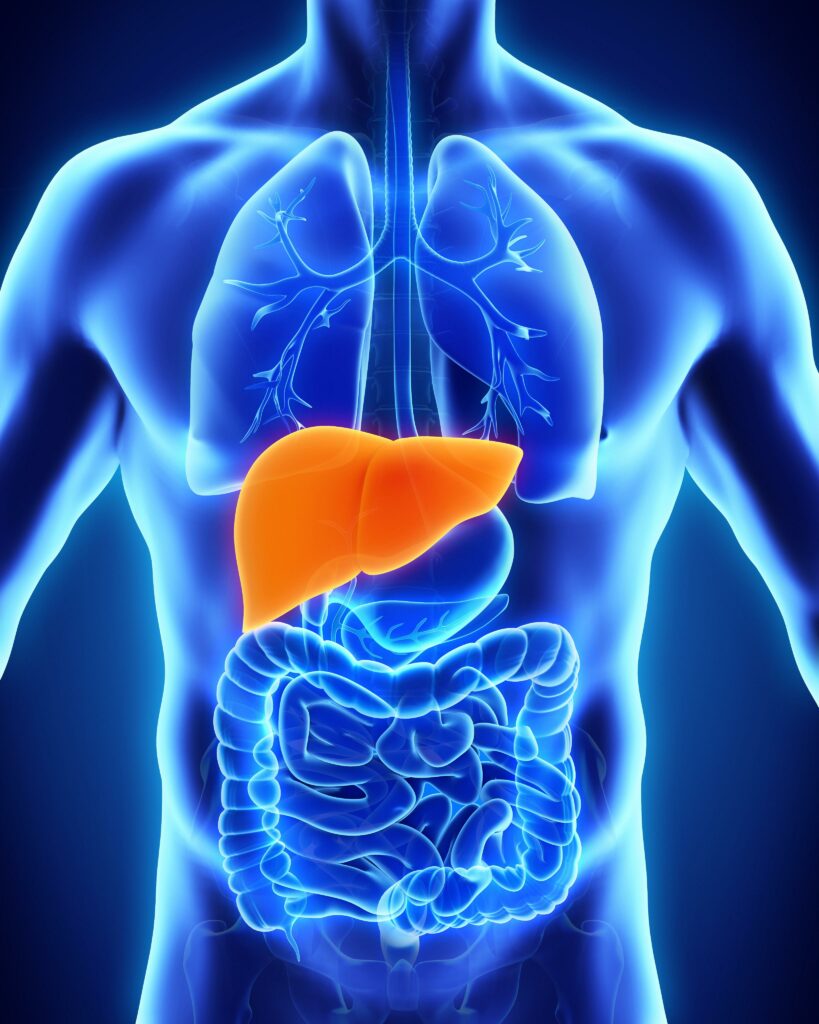 Untitled 3