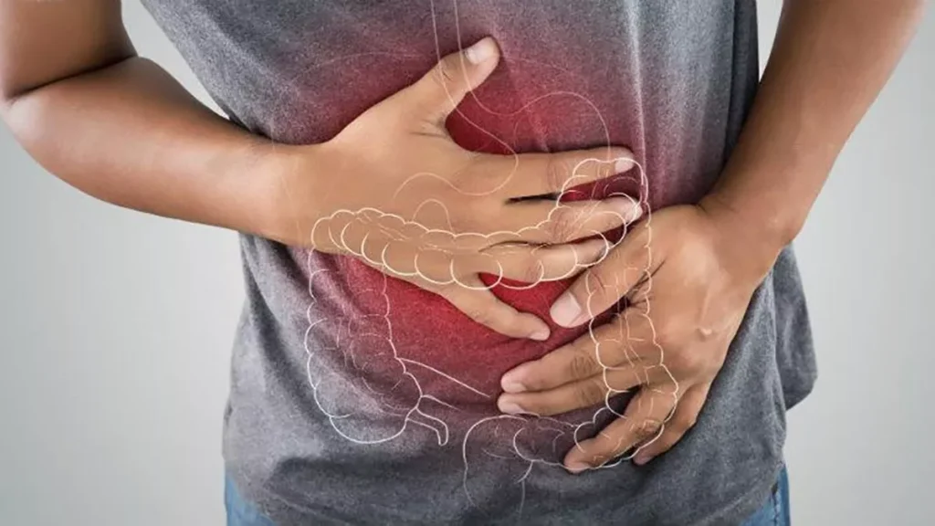 colon irritableok.jpg