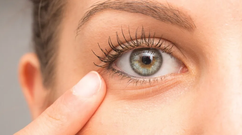 Representación gráfica de salud ocular