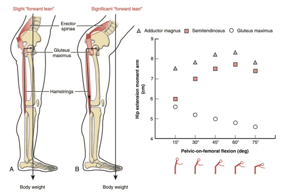 Extensores de la cadera