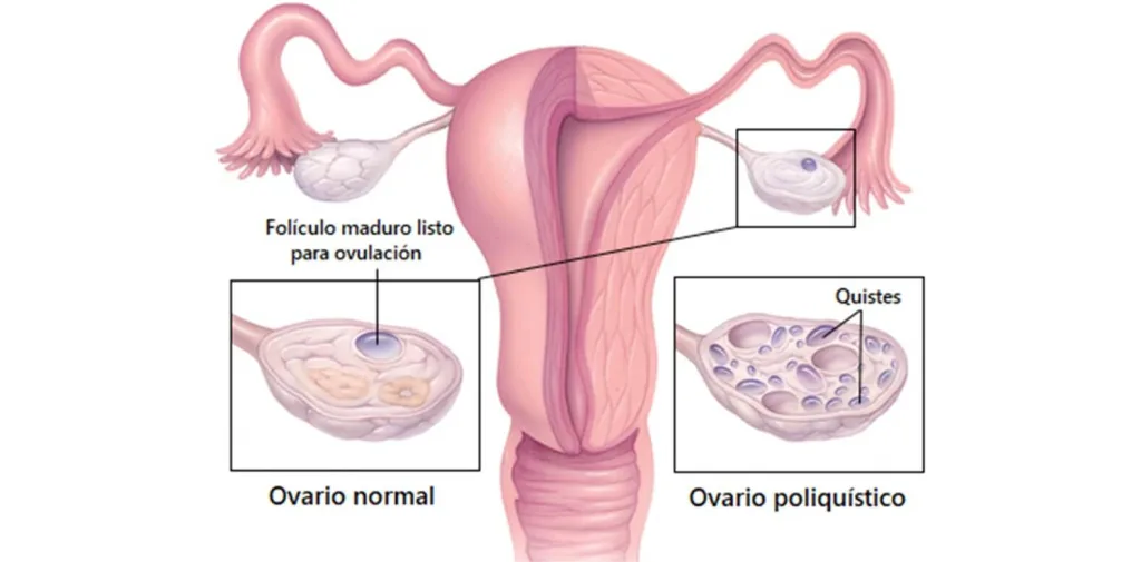 beneficios del inositol