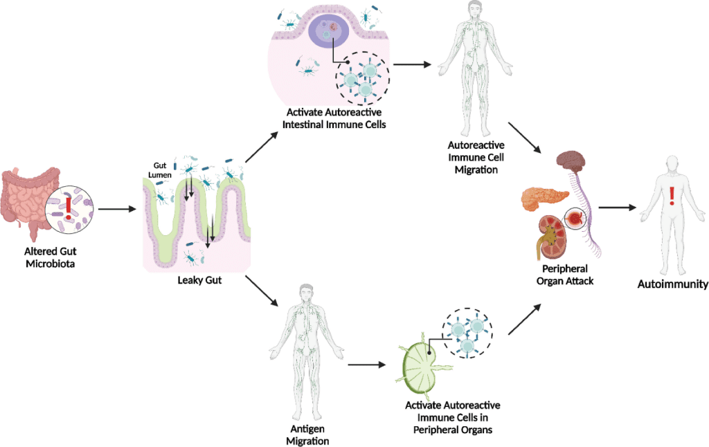Disbiosis microbiana e intestino permeable