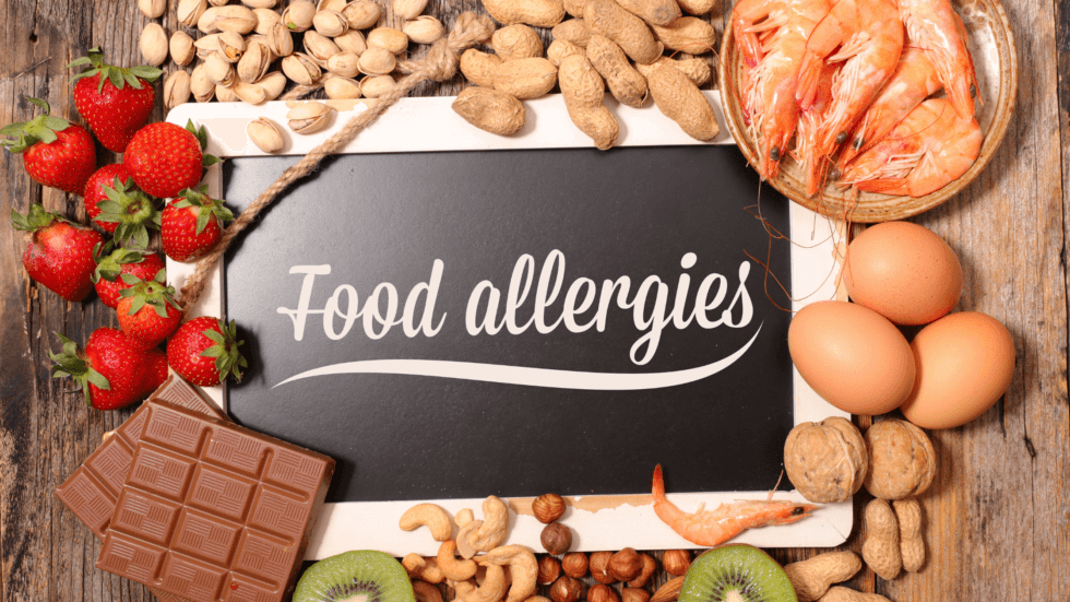 Cómo atender a pacientes con alergias alimentarias 1 Alergias alimentarias