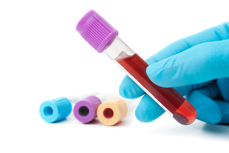 Evaluación bioquímica