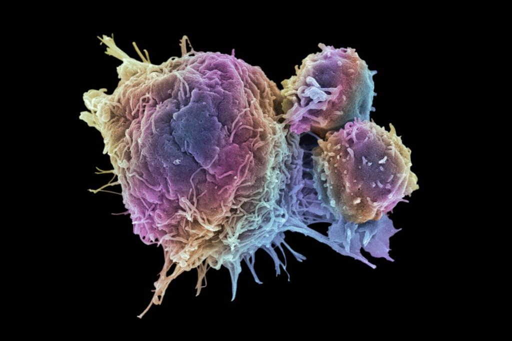 ¿Qué es el ciclo de Krebs y cómo afecta tu energía? 9 Roles anabólicos ciclo de Krebs