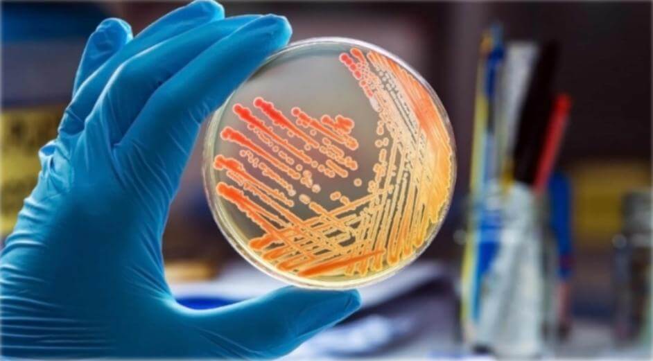Análisis microbiológico proteína en polvo