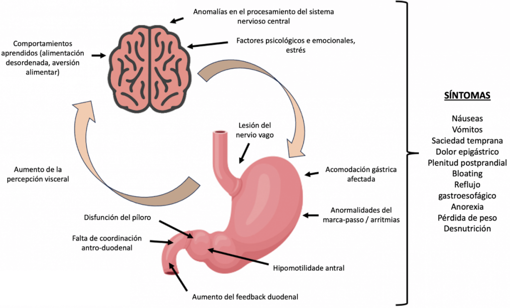 La gastroparesia complicación crónica