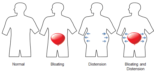 Diferencias hinchazón y distensión abdominal