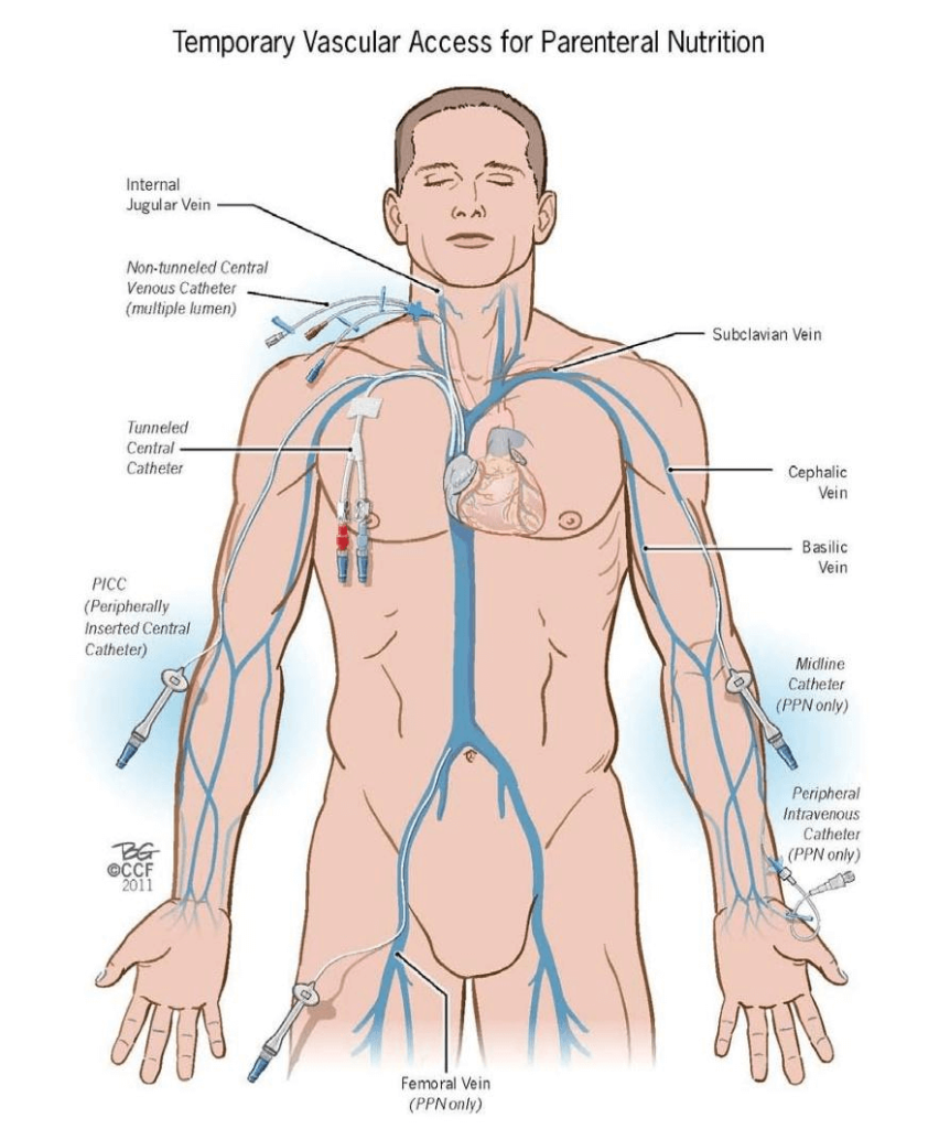 Diferentes vías de acceso vascular