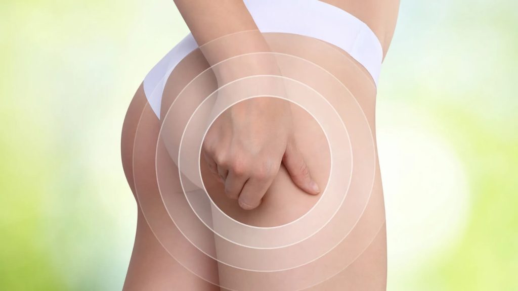 Reducir las celulitis gimnasio