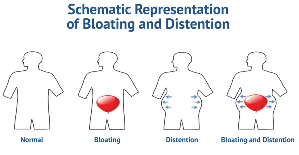 Cómo eliminar la hinchazón abdominal (causas y soluciones) 8 Abdomen en cuatro situaciones distintas