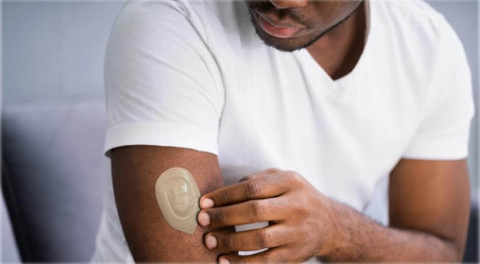 Efectos dermatológicos hombres