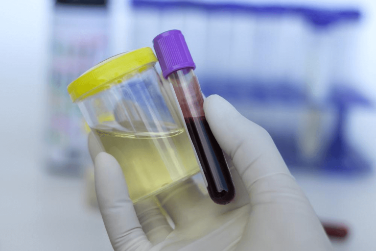 Test antidoping en culturismo