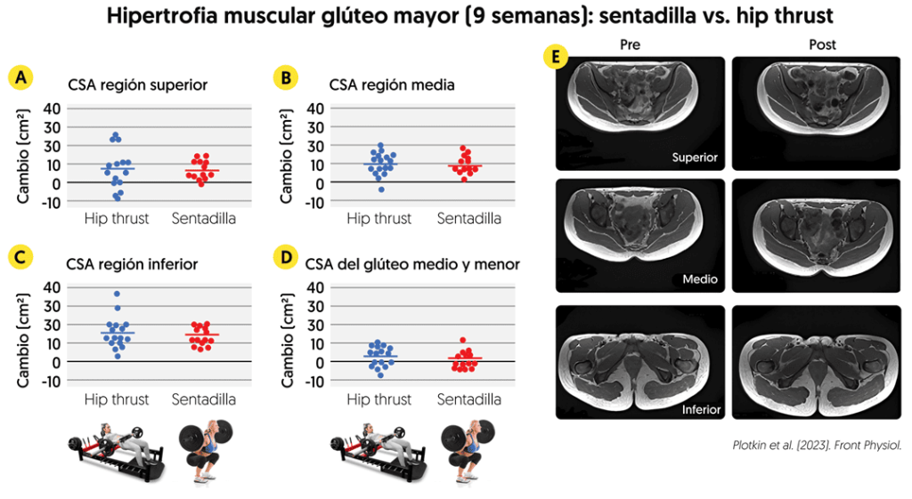 Sentadilla vs hip thrust: diferencias de activación muscular 9 Hipertrofia regional del glúteo