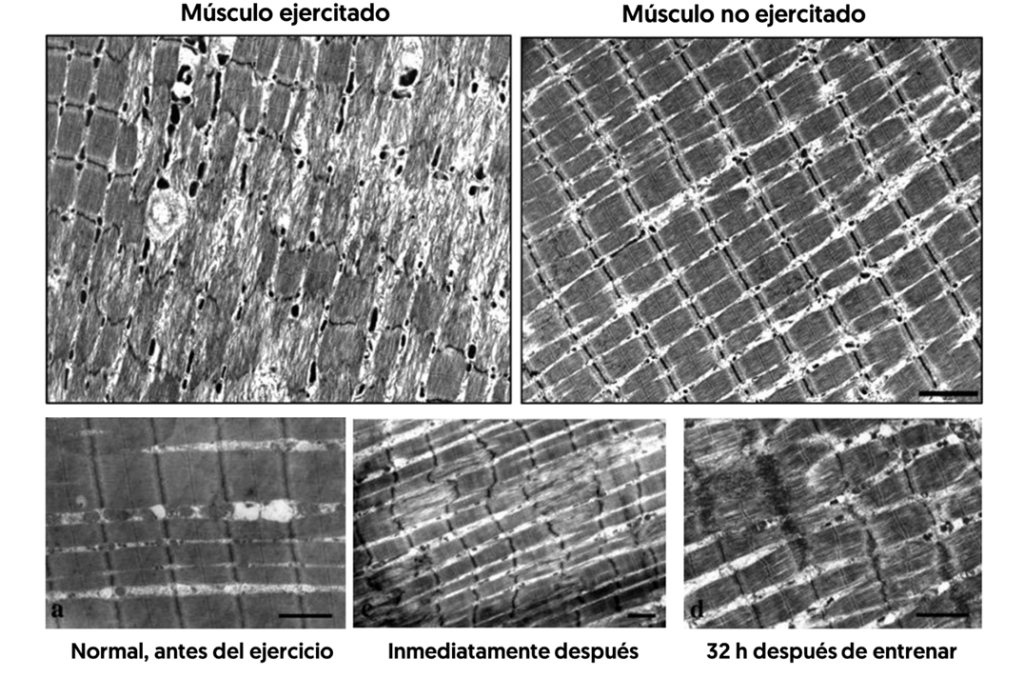 Cambios estructurales en el músculo 