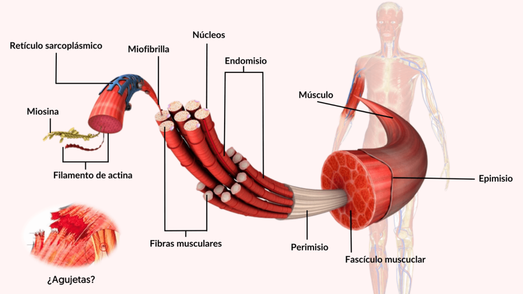 Agujetas asociadas al ejercicio