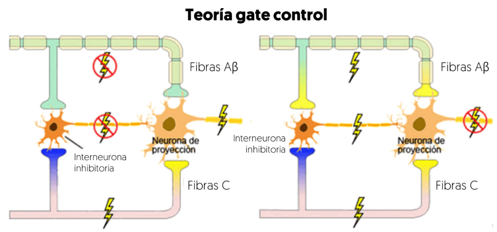Teoría de la compuerta del dolor