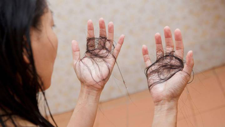 Caída de cabello y problemas en la piel