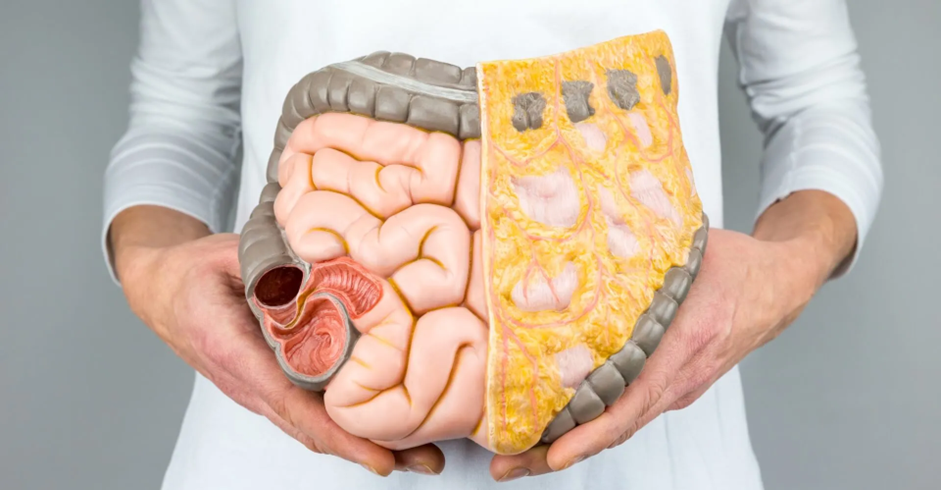 Nutrición y Cáncer de mama: por qué la etiqueta "Plant-Based" puede ser una trampa 11 image 171