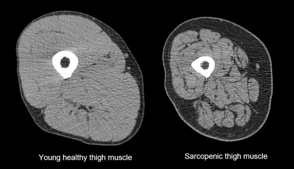 ¿Cómo influye la nutrición para evitar la pérdida de masa muscular después de los 50? 3 image 5